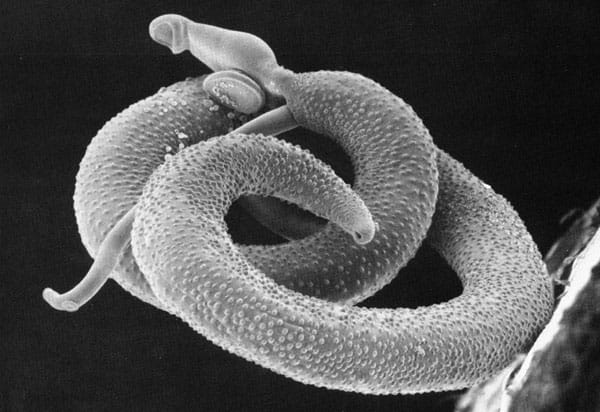 schistosoma mansoni krv.media