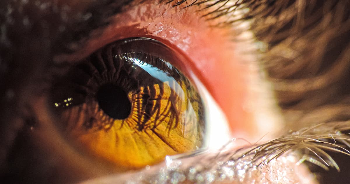Скан ока виявляє ризик серцевих хвороб — нове дослідження