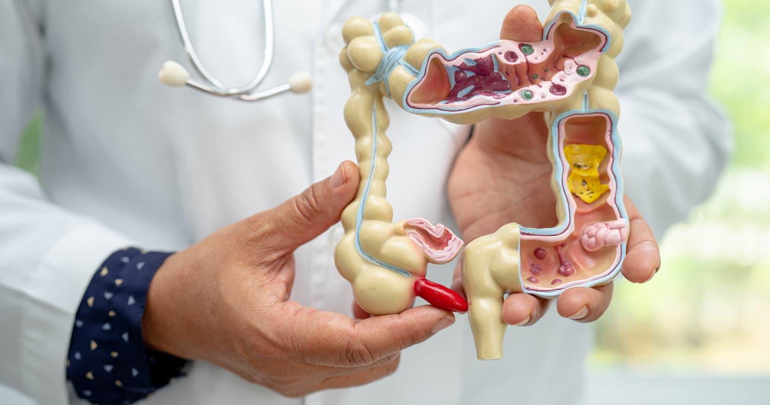 Медики фіксують сплеск раку апендикса серед мілленіалів